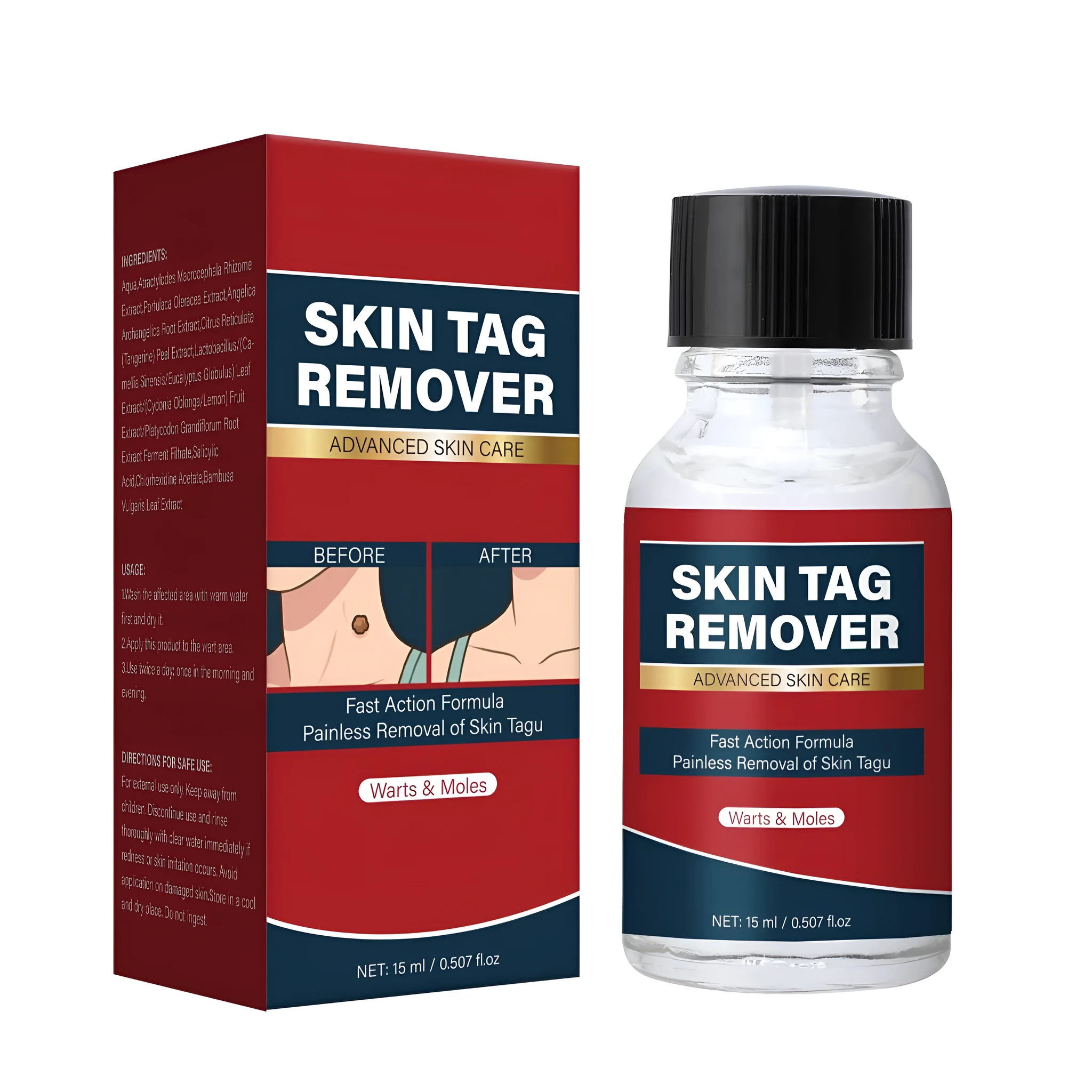 Dermatophytes Remover 15ml bottle with specification FP-A084 for topical fungal skin treatment