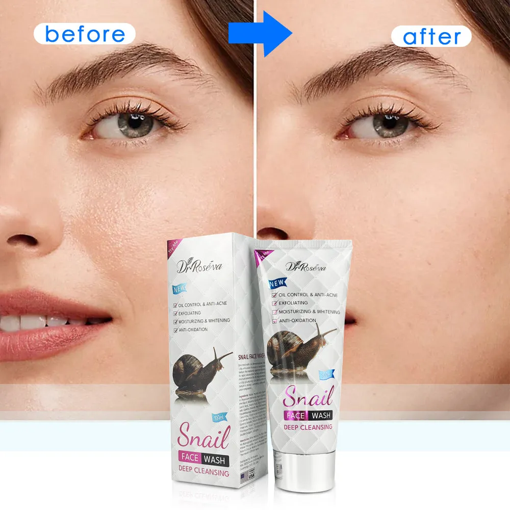 DR.ROSEVA snail facial set with cleanser, face cream, and serum on a white background