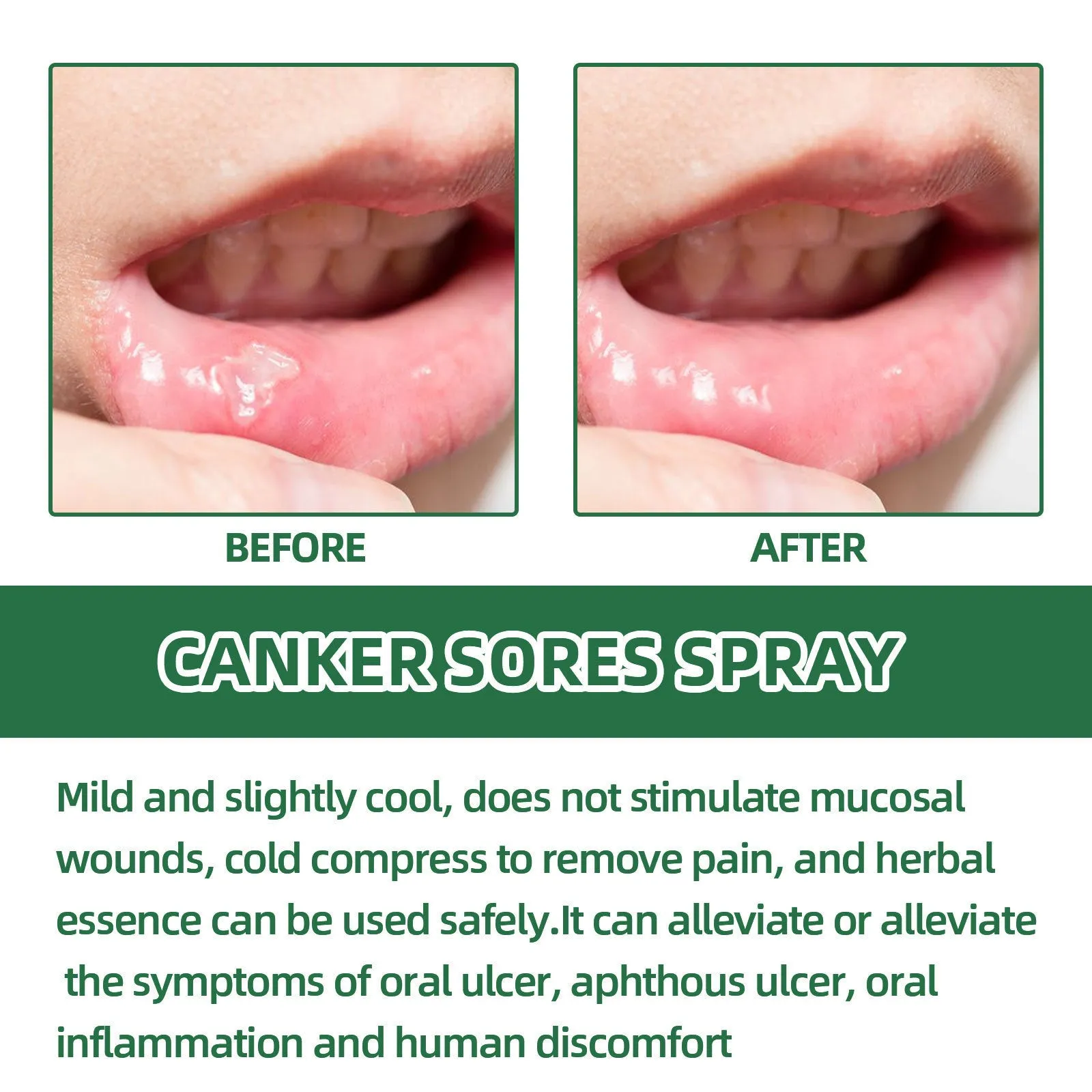 20ml mint flavour oral care spray in boxed packaging for breath freshening