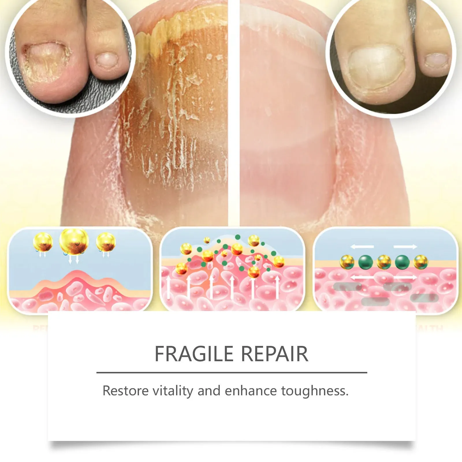 50ml bottle of nail fungus care solution with bee venom and peppermint oil formula