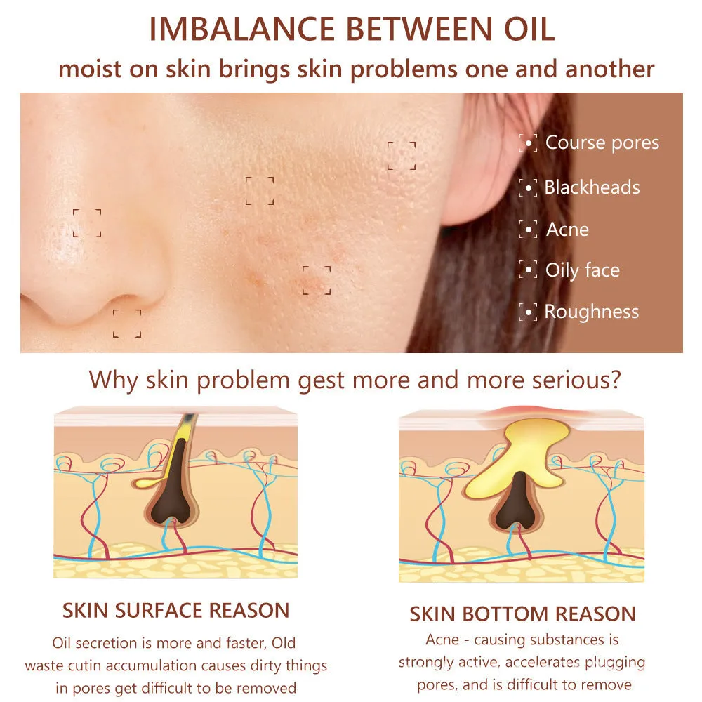 30 ml salicylic acid facial essence serum bottle for pore care and moisturising