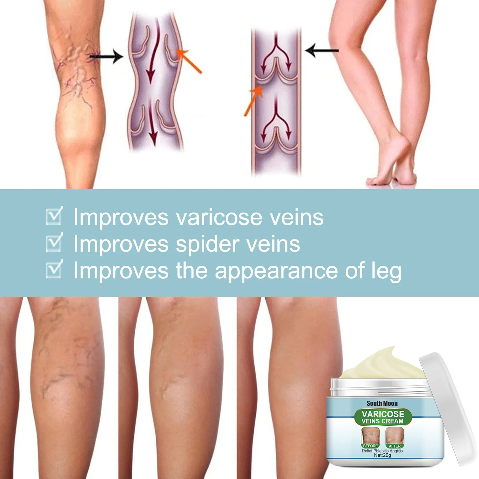 20g vein repair cream container for leg vein relief and green tendon bulge appearance