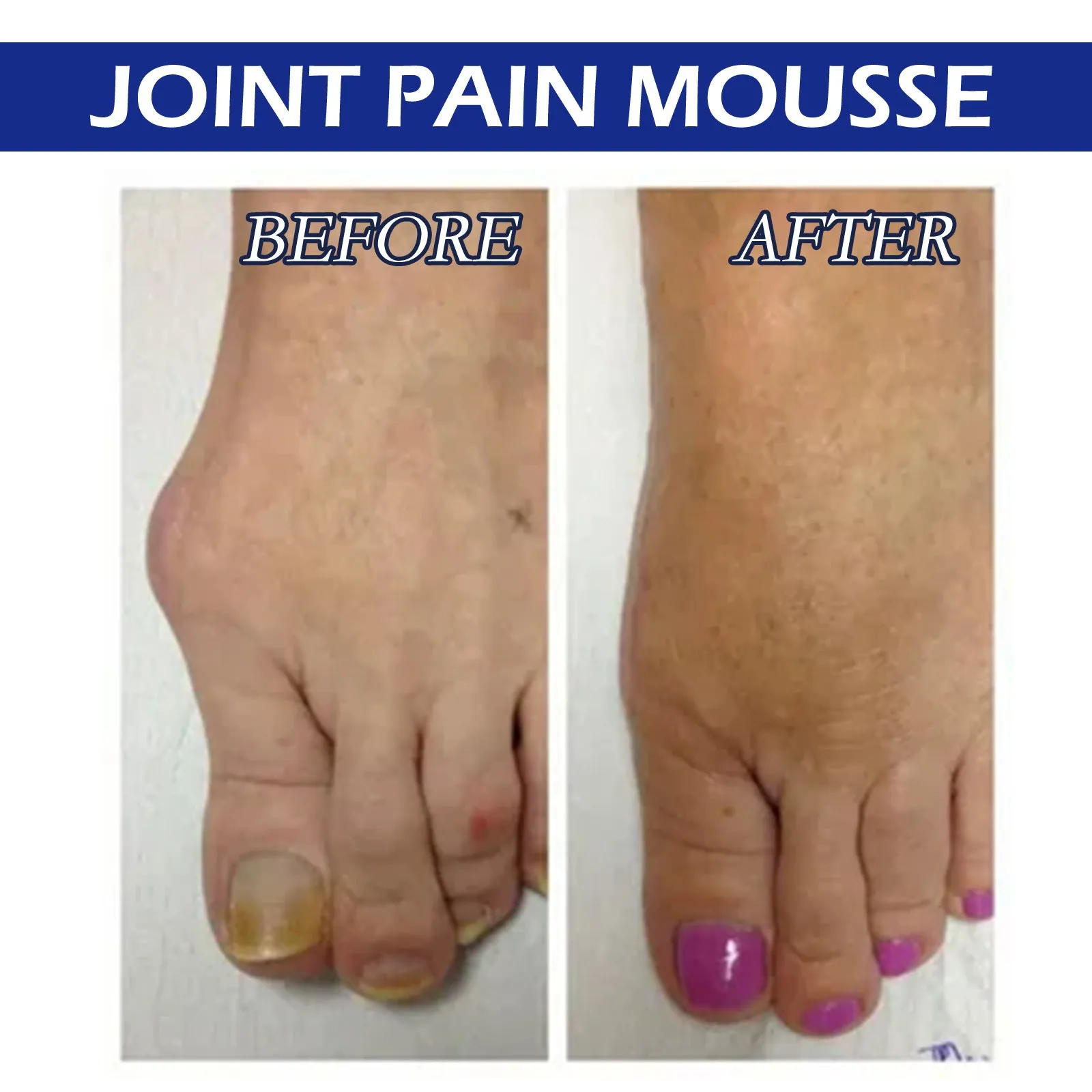 15ml bottle of herbal body care solution for joint massage and muscle relief