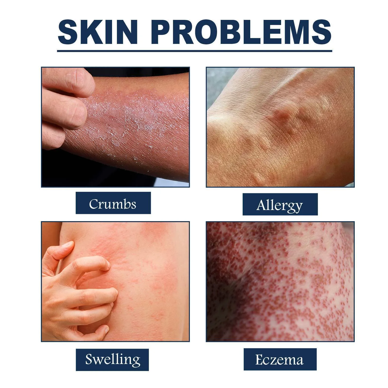 30ml skin itching repair spray with Kraft moss care formulation for body use
