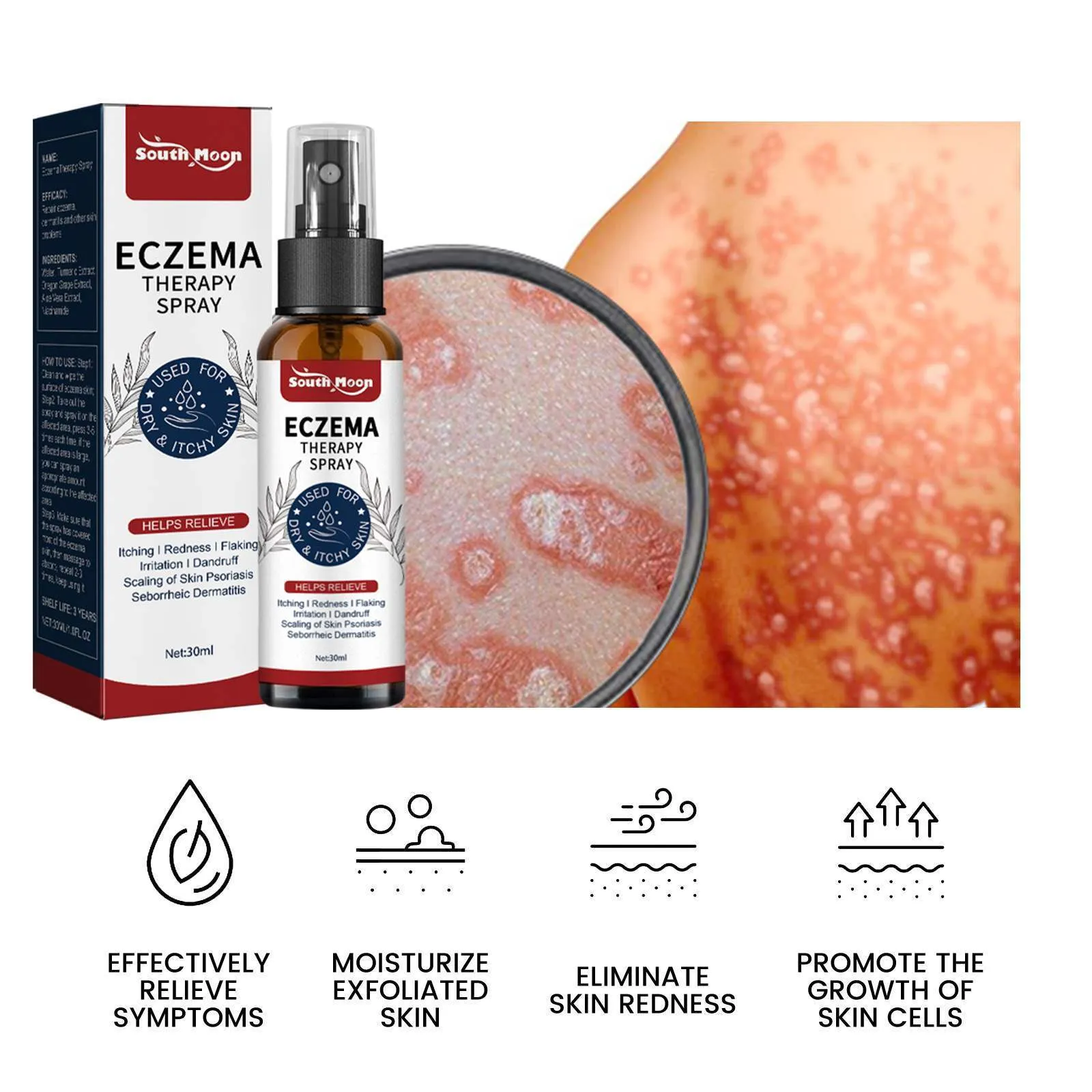 30ml skin itching repair spray with Kraft moss care formulation for body use