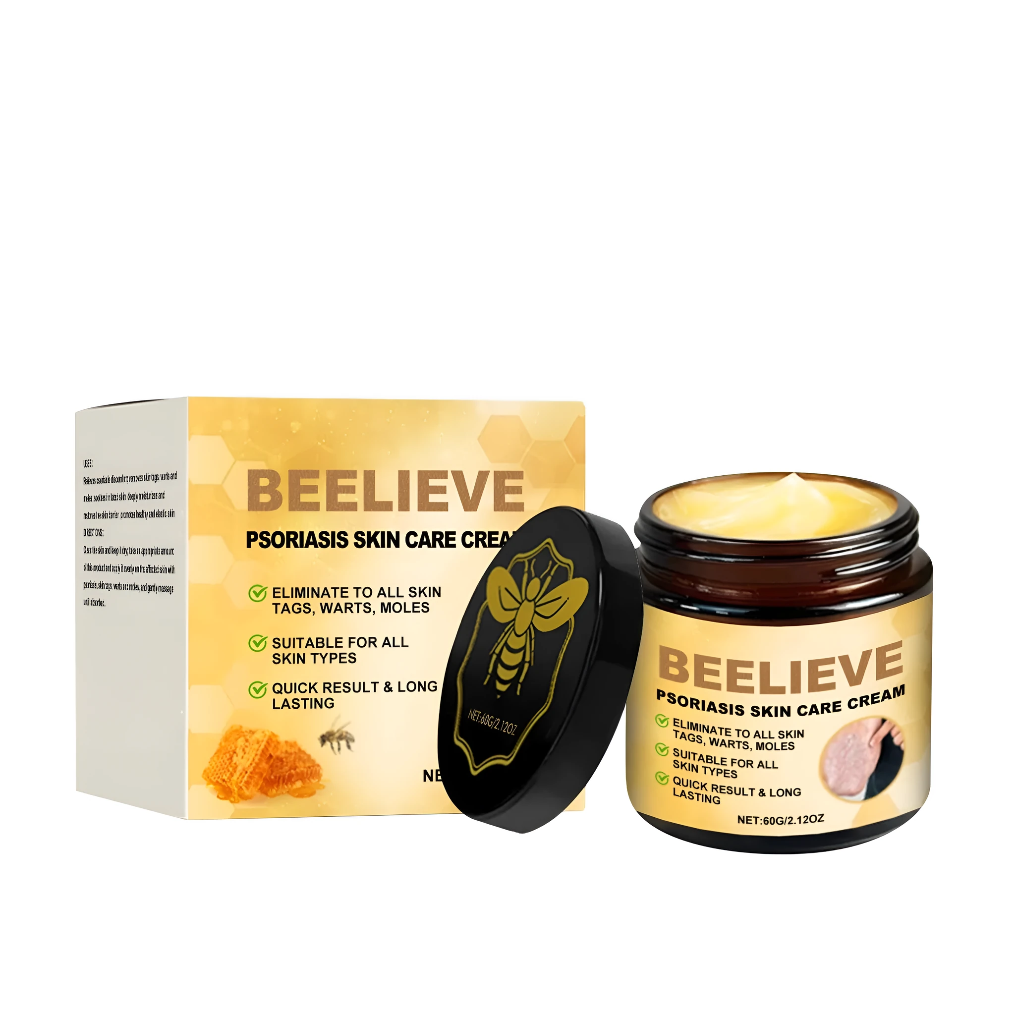 Psoriasis skin care cream 60g tube with bee venom and mint leaves for soothing dry itchy skin