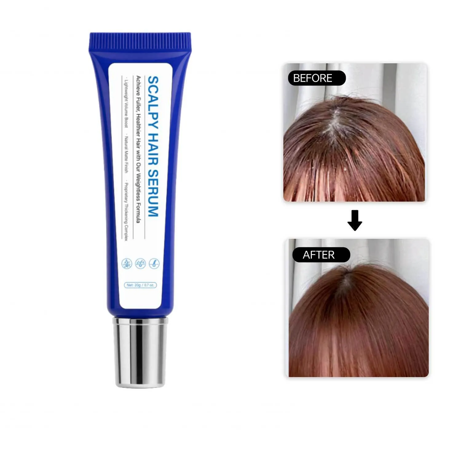 Scalp Hair Repair 20g Scalpy Hair Serum pack for damaged scalp care and hair restoration