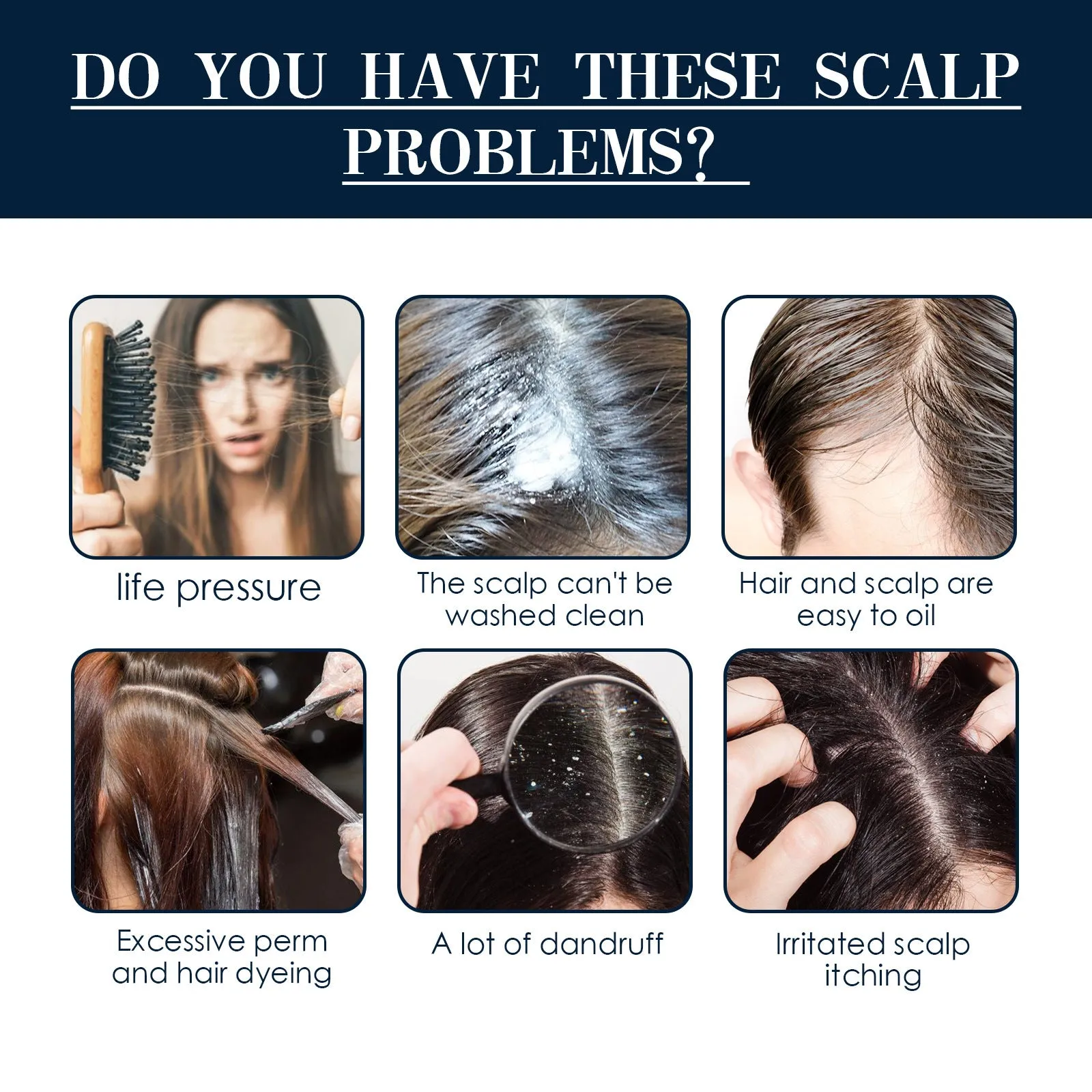 30ml Hair Root Care Spray in a bottle with a spray nozzle, designed for scalp itch relief and follicle nourishment.