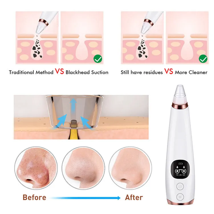 White facial instrument cleanser with vacuum suction head for blackhead removal