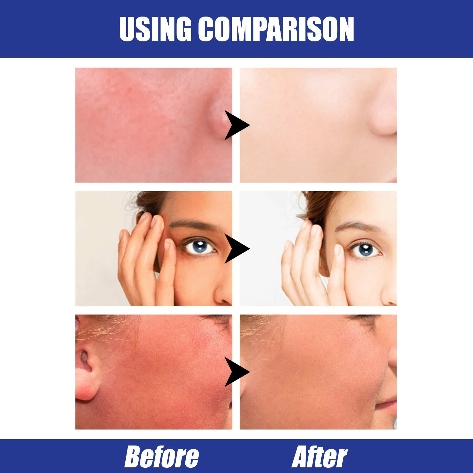 Hyaluronic Acid Sun Block Stick 22g waterproof SPF50 sunscreen in stick form