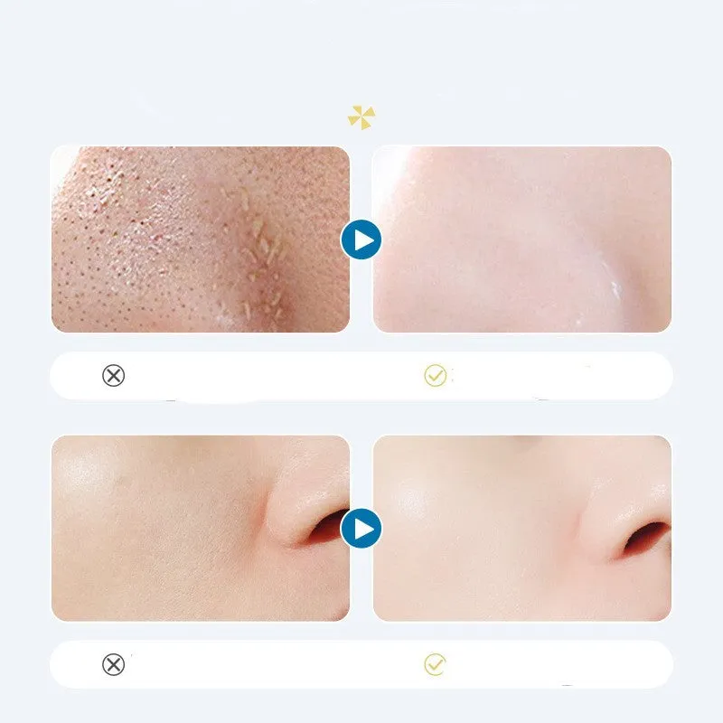 Oligopeptide Small Bubble Cleaning Essence in single-use 1.5ml sachets, 10 per box, with peptide formula for gentle daily face wash