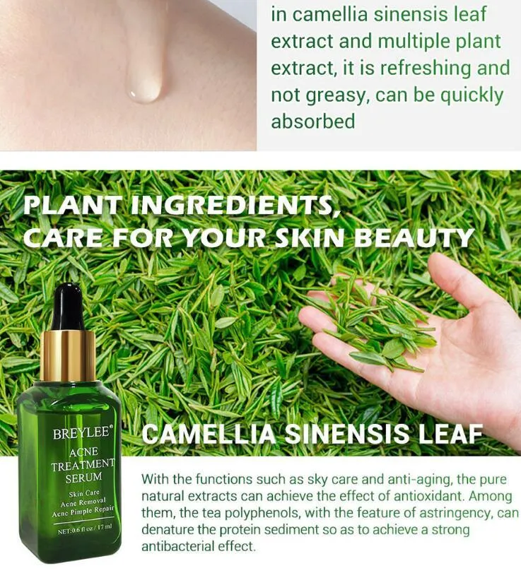 Acne treatment serum facial repair oil with Camellia sinensis leaf extract liquid formulation