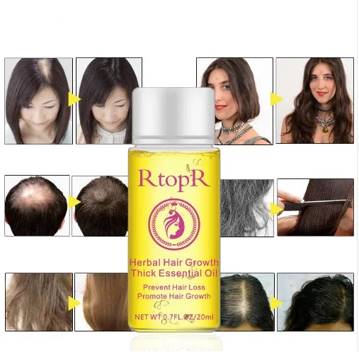 Hair growth essential oil liquid treatment 20ml bottle rose colour preventing hair loss