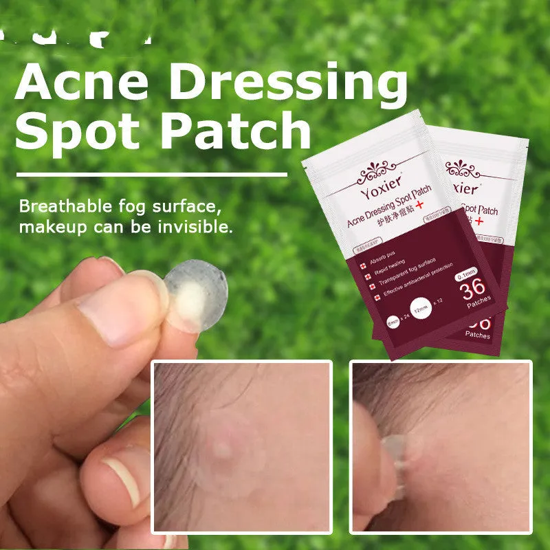 Acne dressing spot patch 0.1mm invisible sticker in red colour with 36-count pack
