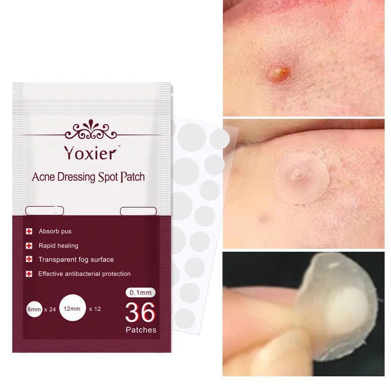 Acne dressing spot patch 0.1mm invisible sticker in red colour with 36-count pack