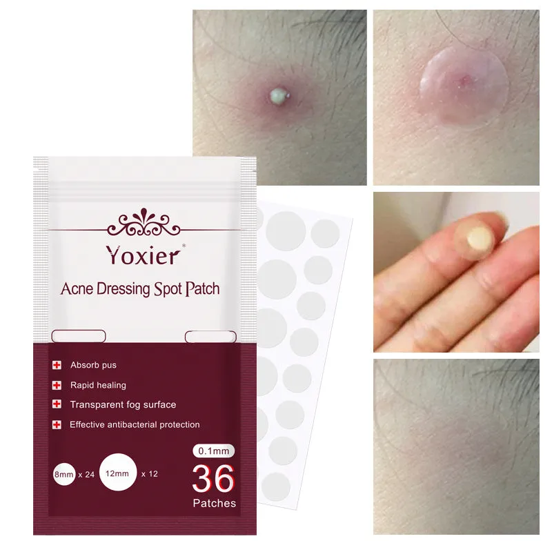 Acne dressing spot patch 0.1mm invisible sticker in red colour with 36-count pack