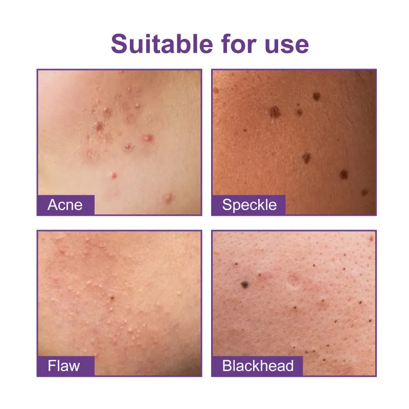 Anti-acne waterproof breathable acne patch pack of 180 pieces in compact 6.5x1.4x9.6cm packaging