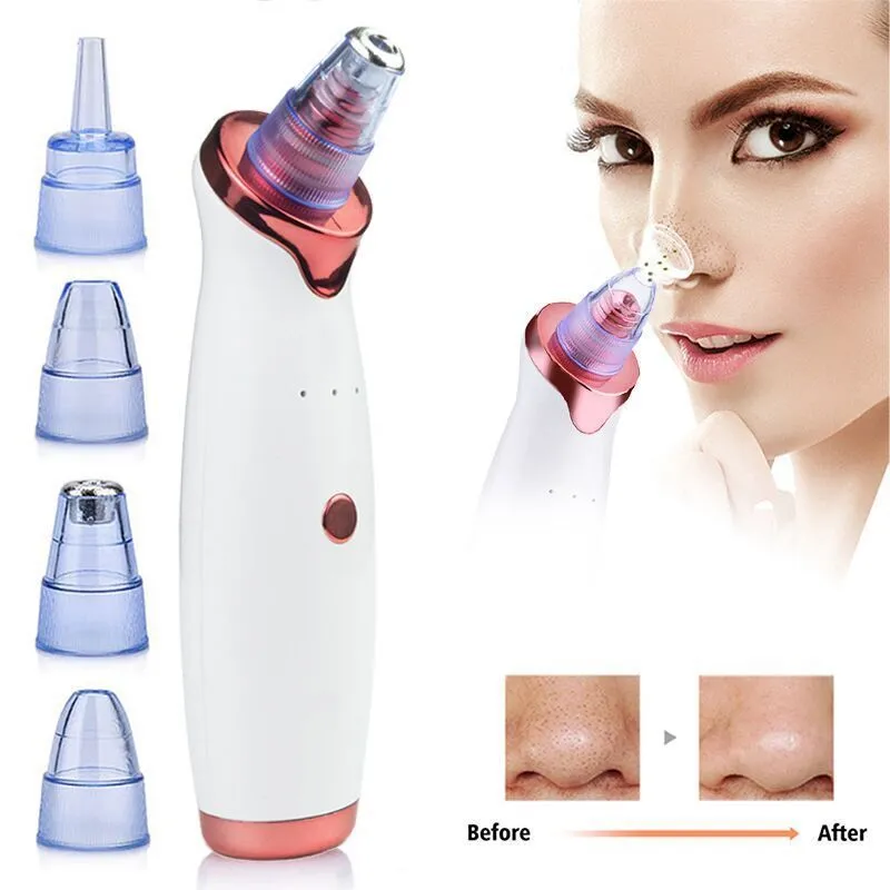 White USB rechargeable ultrasonic pore cleansing beauty device for blackhead removal and acne care