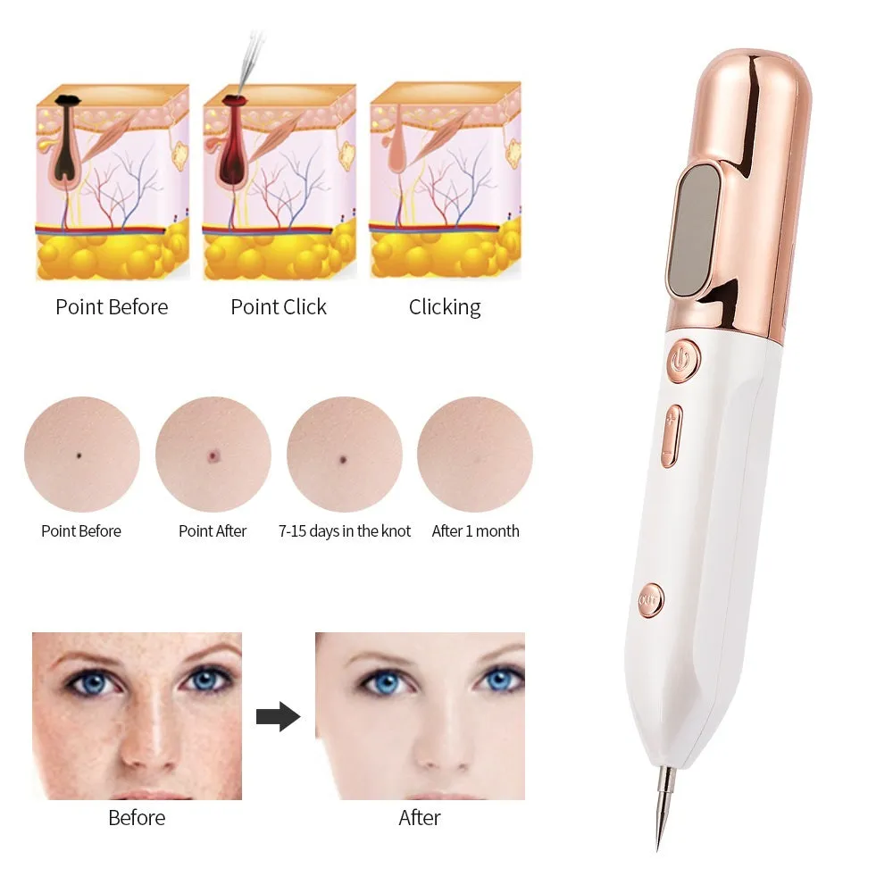 Blue light acne beauty instrument removal pen set with cooling gel and needles on a table