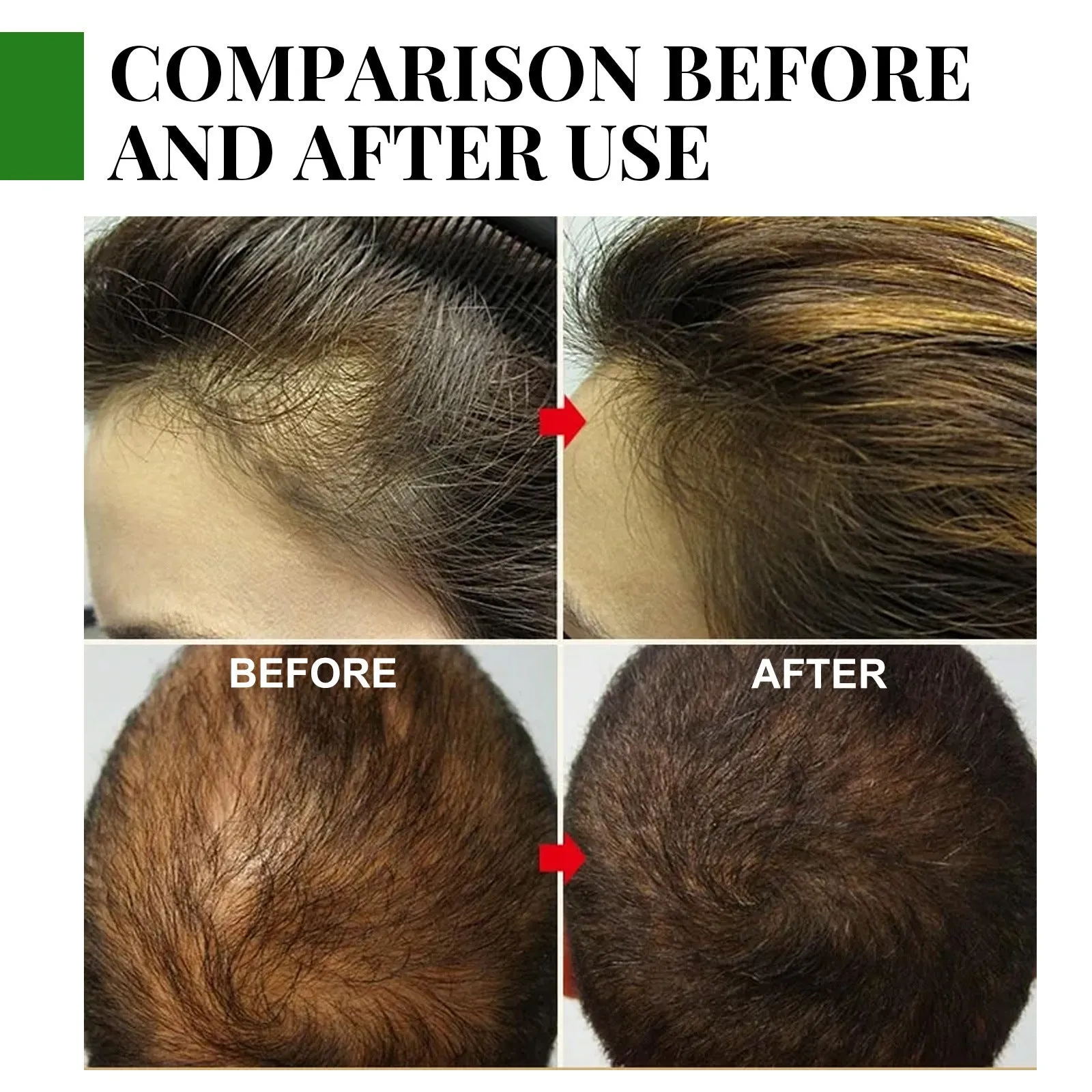 Rosemary hair care essential oil 30ml boxed bottle for anti-loss scalp treatment