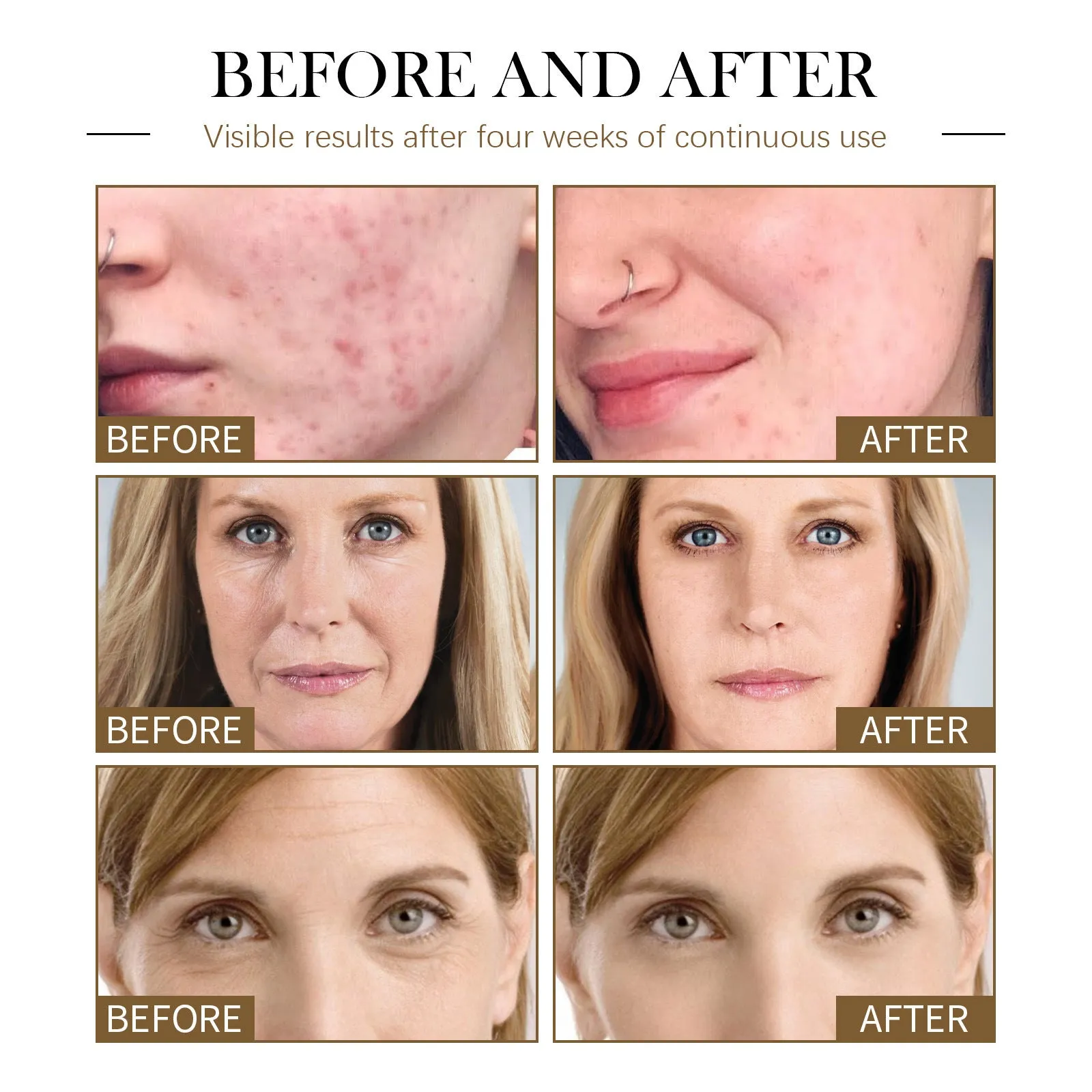 30ml facial replenishment firming skin care solution moisturizing essential oil bottle