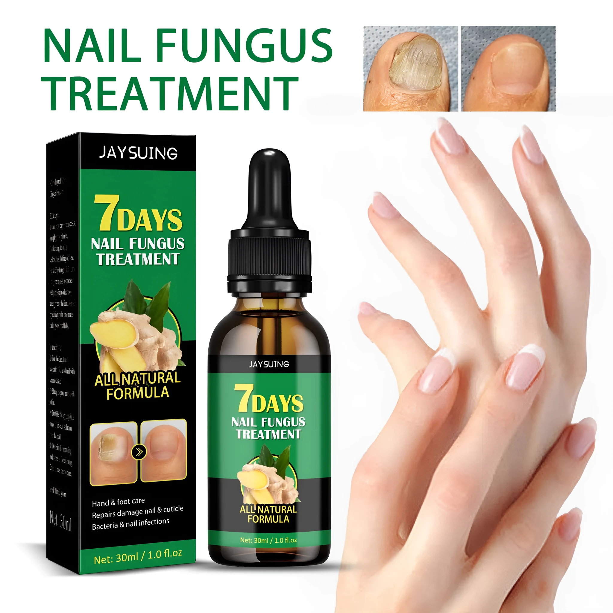 30ml ginger nail care lotion bottle on white background, with nail stickers and Set colour packaging