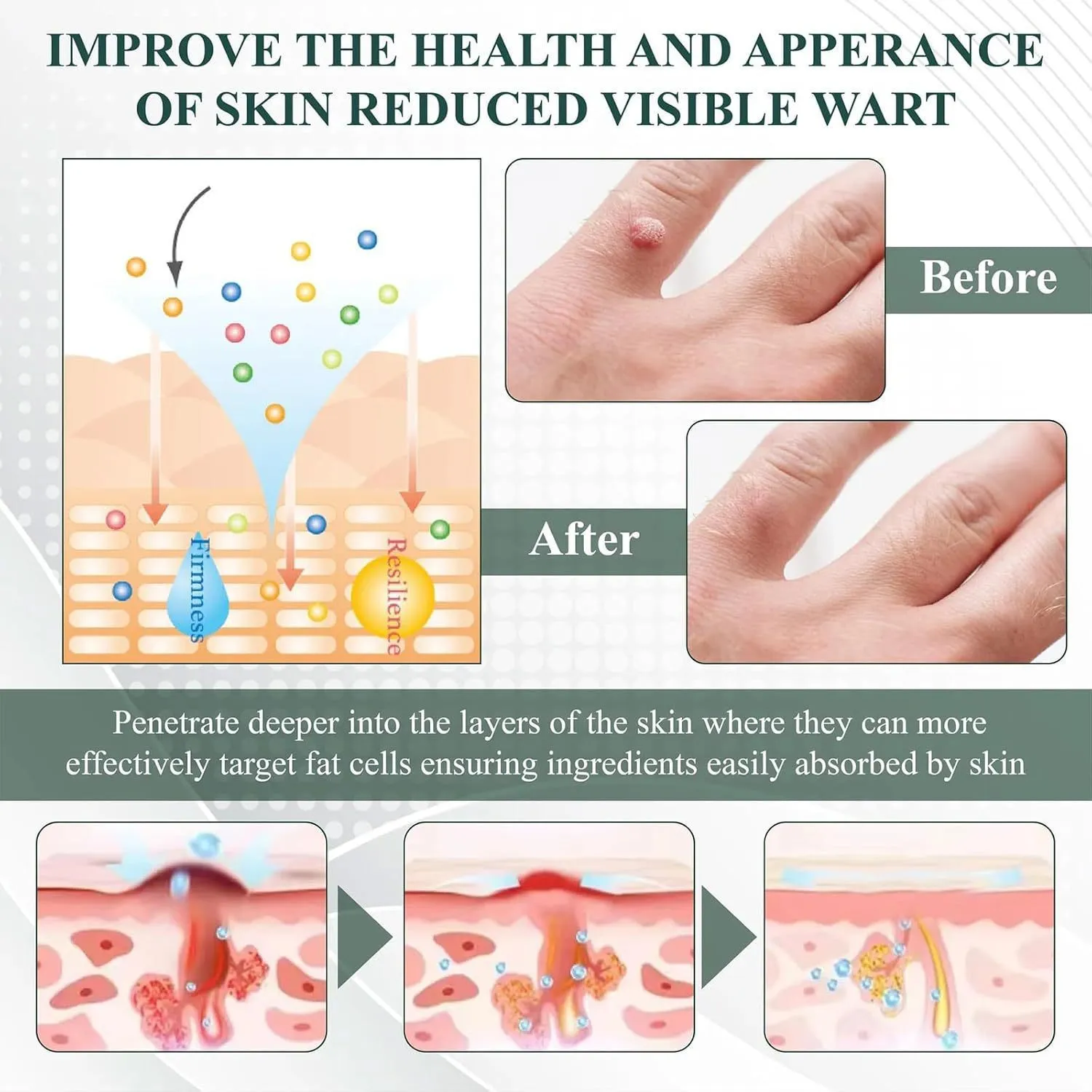 Natureerase Instant Mole Spot Removal Gel 45g tube on white background