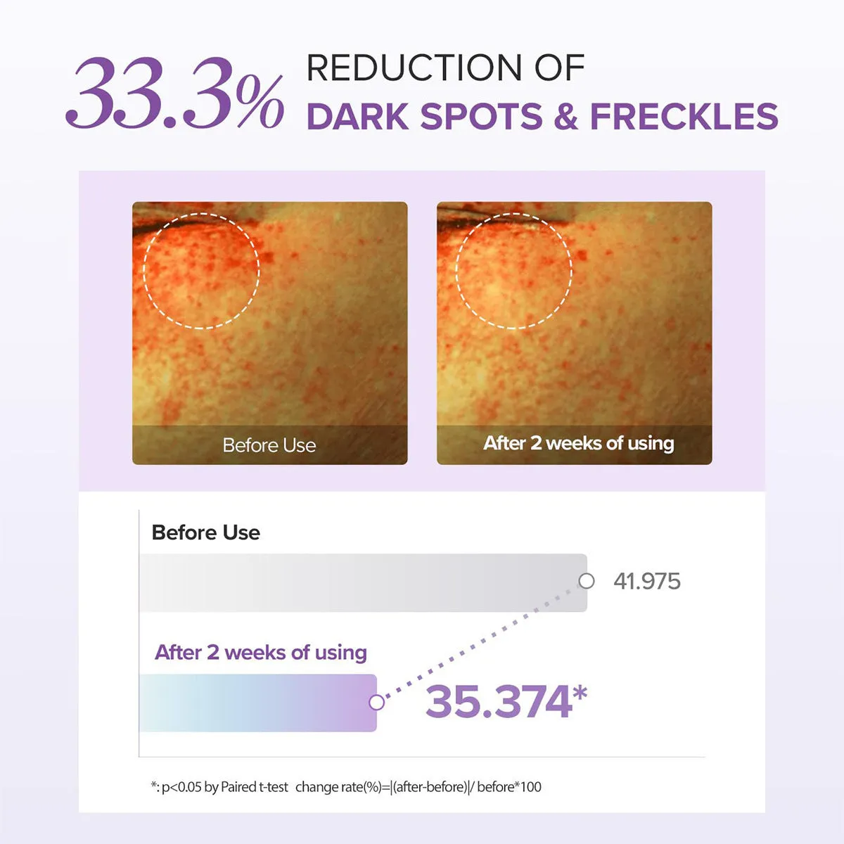 Moisturising and blackening eye neck cream 30ml standard specifications for dark circles