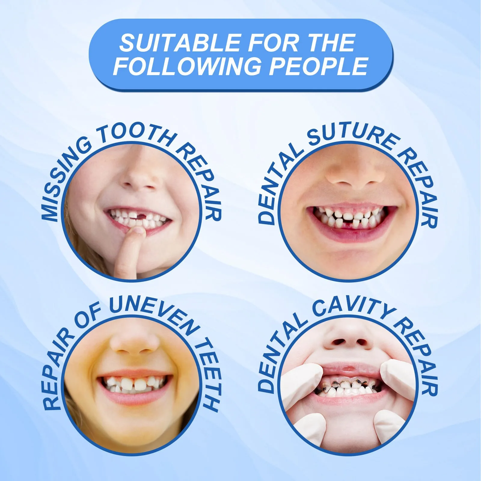 30ml disposable plastic solid teether particles teeth joint filling glue for adult temporary dental repair