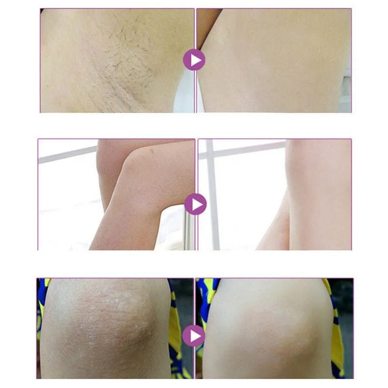 Aichun Armpit Whitening Cream 50g jar with extraction essences for underarm whitening and odour control