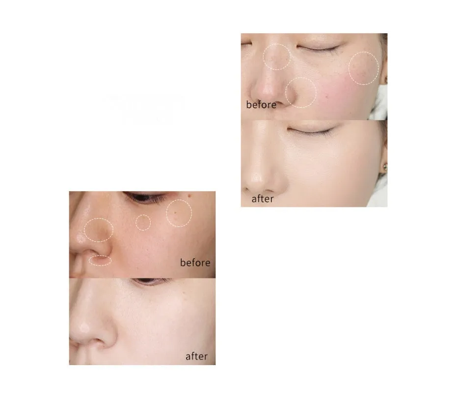 Whitening cream 20g tube for brightening skin and reducing dark spots
