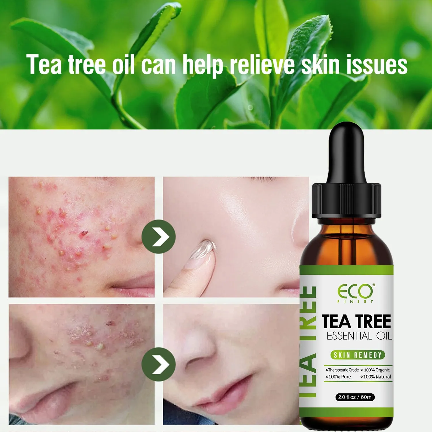Tea tree oil essential oil bottle 60ml for acne skincare and massage applications