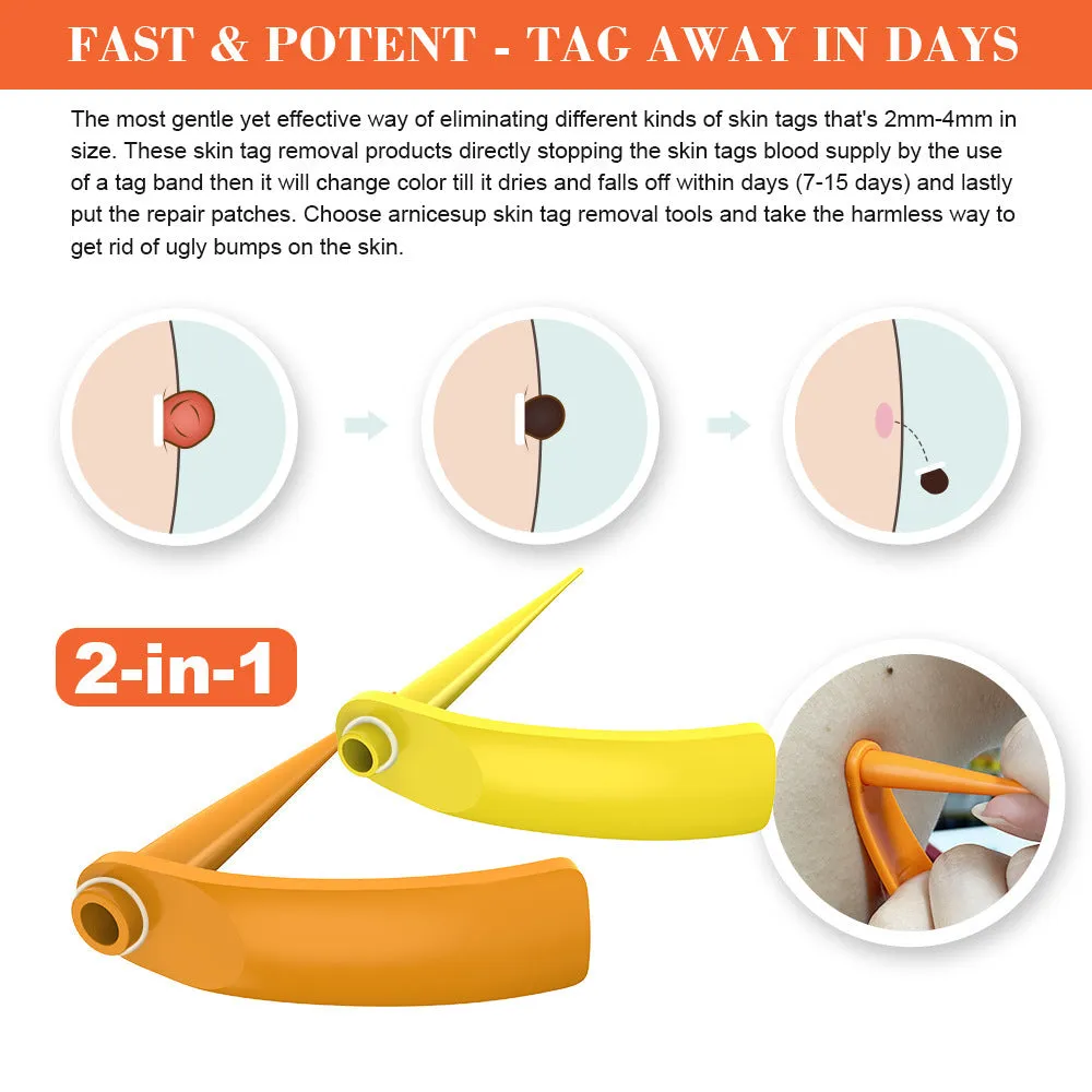 Orange mole removal tool kit with wart remover device, rubber rings, alcohol swabs, and repair sticker