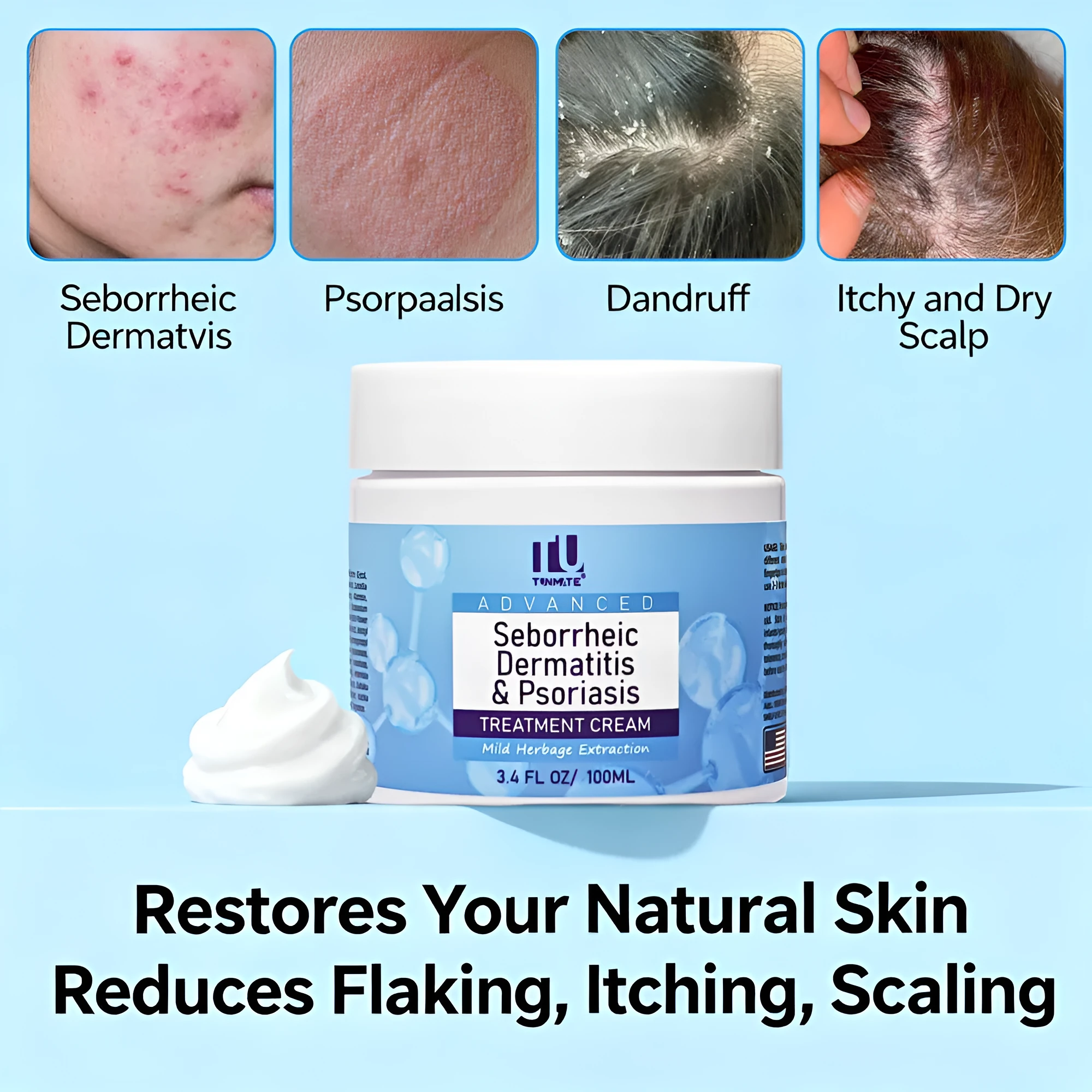 Seborrheic dermatitis cream tube 100ml for scalp psoriasis eczema treatment