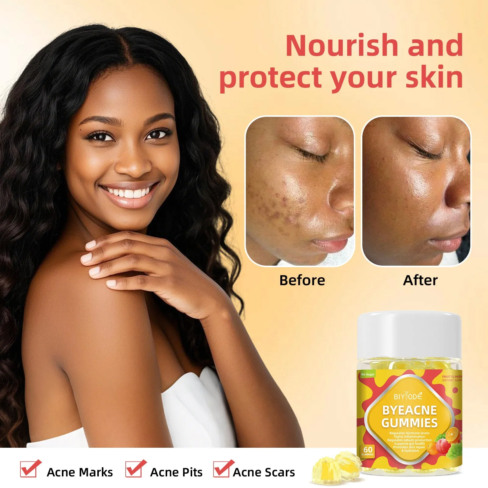 Private label ByeAcne Gummies bottle for hormone balance and acne reduction with vitamins, zinc, and magnesium