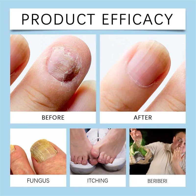 20ml nail cleaning liquid bottle with clear solution for manicure prep