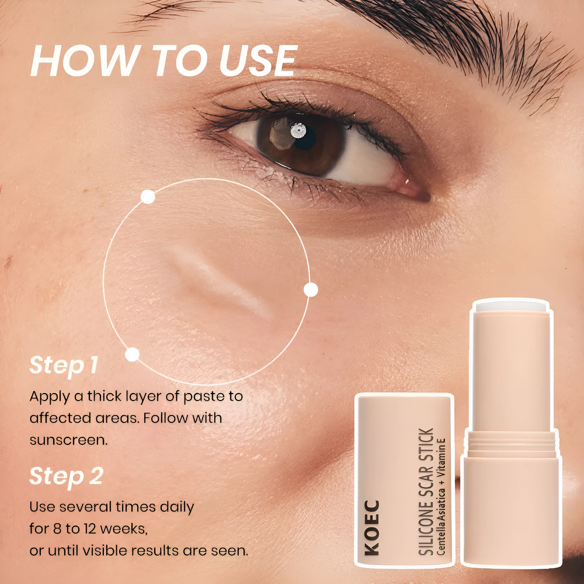 Silicone Scar Stick 7g in compact stick form for scar moisturising and soothing