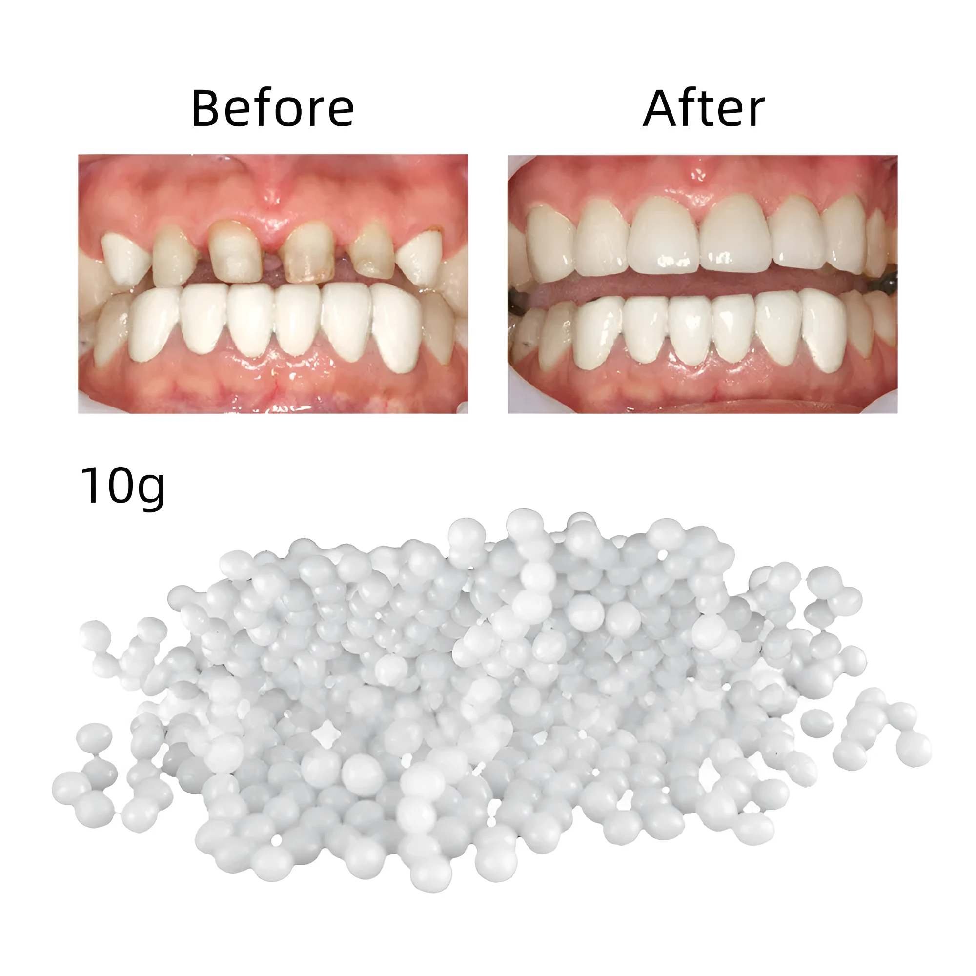 Bagged household teeth repair solid hot-soluble teether for temporary missing teeth gap fix