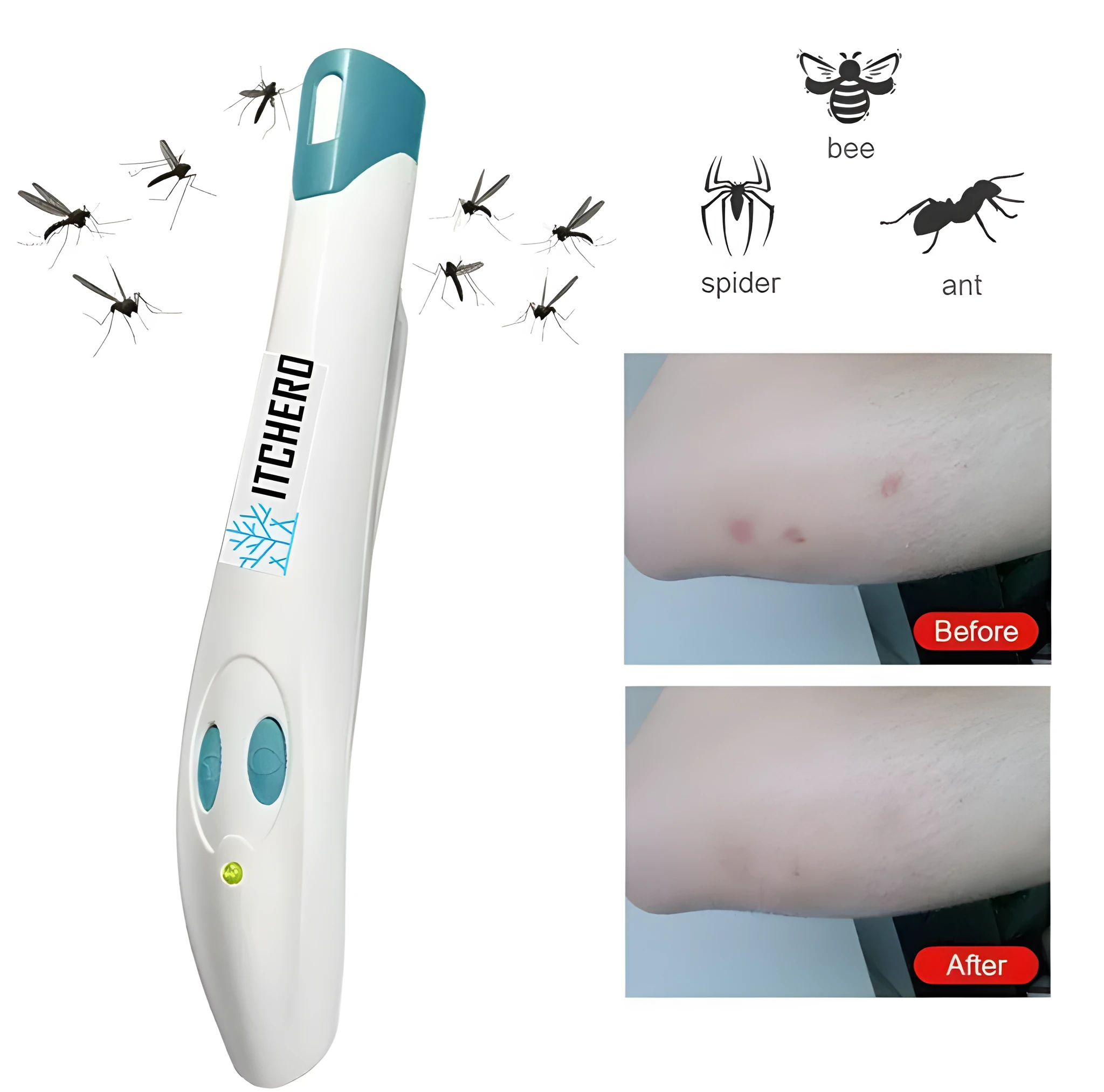 White blue electronic mosquito bite antipruritic pen on white background