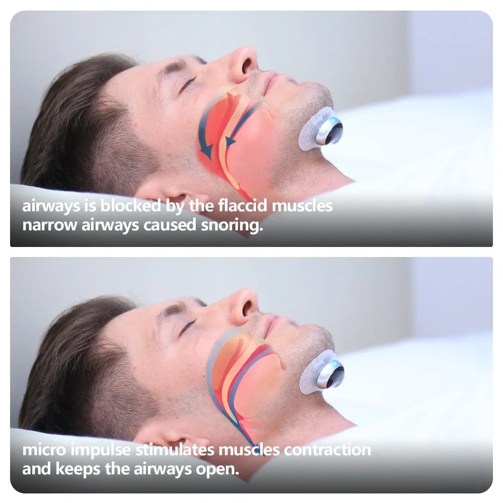 Electronic muscle stimulator chin device for anti-snoring sleep aid models YA4101 and YA4200