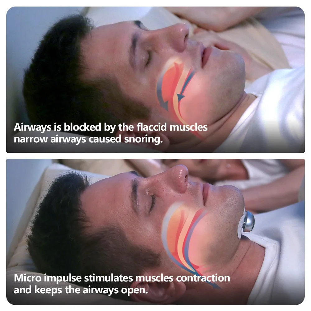 Smart Anti Snoring Device Electronic Muscle Stimulator Pro YA4300 under chin