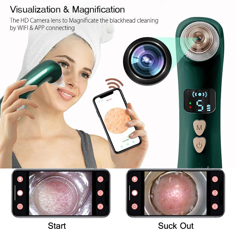 Green and white handheld heating blackhead instrument with USB charging port and suction nozzle